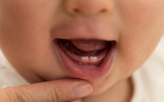10 Natural Remedies for Teething Infants to Soothe Sore Gums